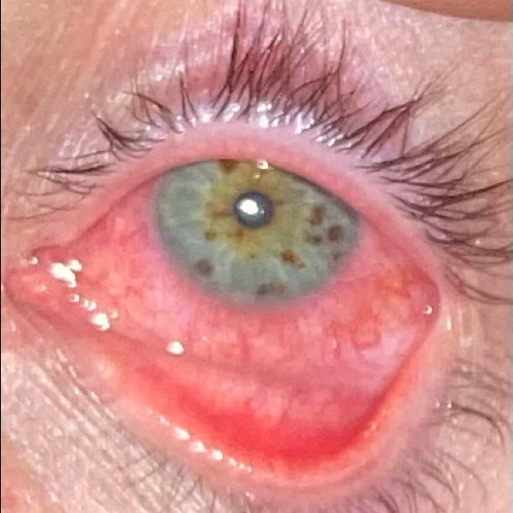 Meet your Posher, Caleb - Picture 1 of 1